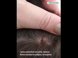 В Ровенской области ТЦКашники избили 17-летнего подростка