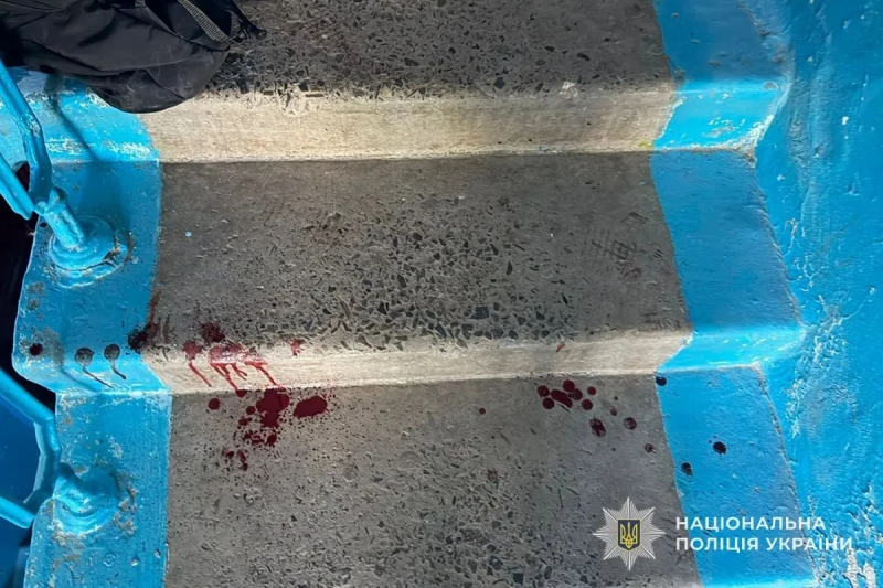 В Тернополе 15-летняя школьница напала с ножом на одноклассницу – врачи борются за жизнь потерпевшей