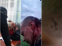 В Житомире ТЦКашники под наблюдением полиции избили мужчину на пороге его дома