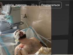 В Днепре ТЦКашники забили мужчину до комы, а полицаи их покрывают