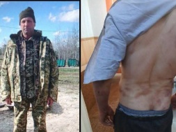 В Ровенской области мужчина умер от пыток и побоев, а написали, что от COVIDа