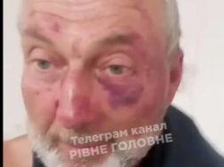 В Сарнах Ровненской области ТЦКашники жестоко избили пожилого ветерана-«афганца»