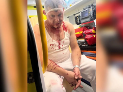 В Польше снова избили украинцев – на этот раз в Кожухуве
