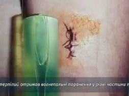 В Запорожье высокопоставленный полицай вломился в постороннюю квартиру, а затем избил и ранил из травмата её хозяина