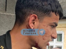 В Закарпатье из-за проверки полиции и пограничников произошёл бунт в цыганском поселении