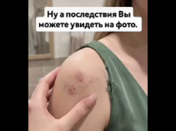 Во Львове официант ресторана избил гражданок Молдовы за русский язык