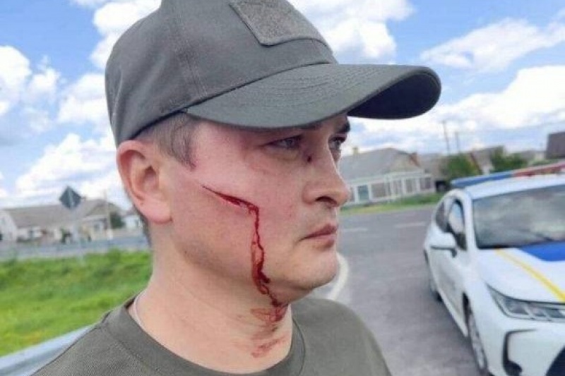 В Ковеле мужчина врезал ТЦКашнику по морде лопатой, защищая свою жизнь и человеческое достоинство