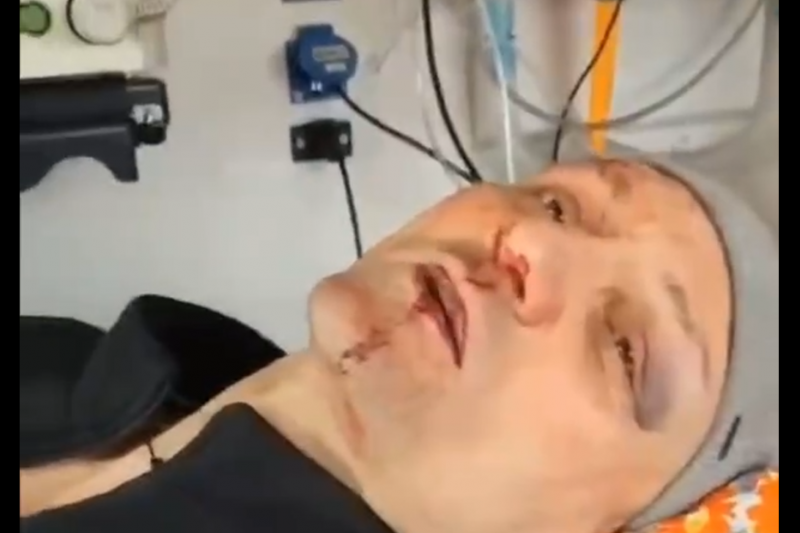 В Харькове ТЦКашники жестоко избили бывшего ВСУшника