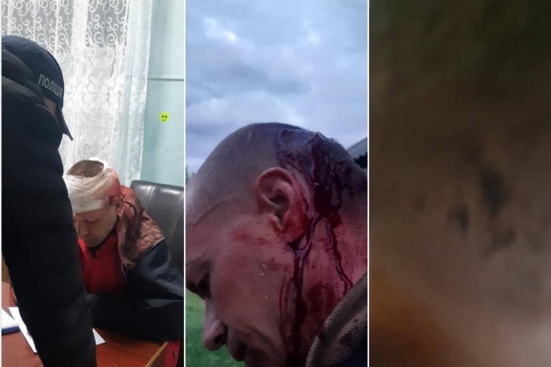 В Житомире ТЦКашники под наблюдением полиции избили мужчину на пороге его дома