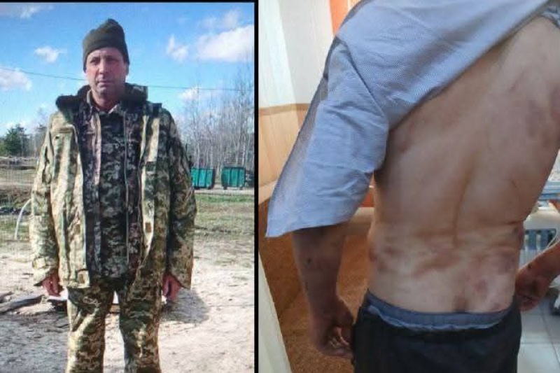 В Ровенской области мужчина умер от пыток и побоев, а написали, что от COVIDа