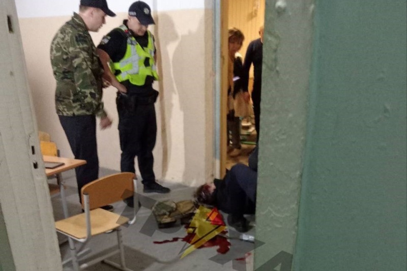 В Киеве во время ракетного обстрела 21-летний парень пытался на нервной почве совершить суицид