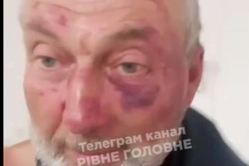 В Сарнах Ровненской области ТЦКашники жестоко избили пожилого ветерана-«афганца»