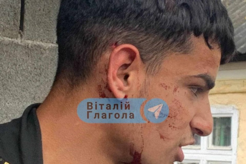 В Закарпатье из-за проверки полиции и пограничников произошёл бунт в цыганском поселении