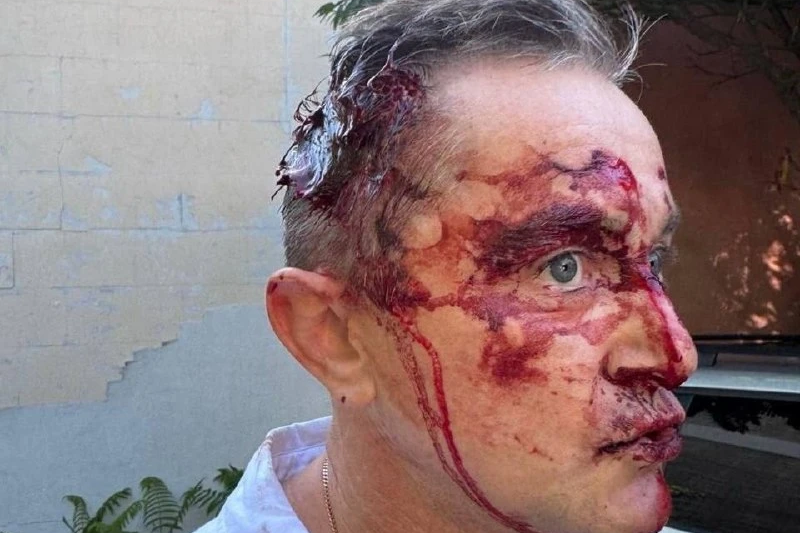 В Сумах полицаи с людоловами жестоко избили врача