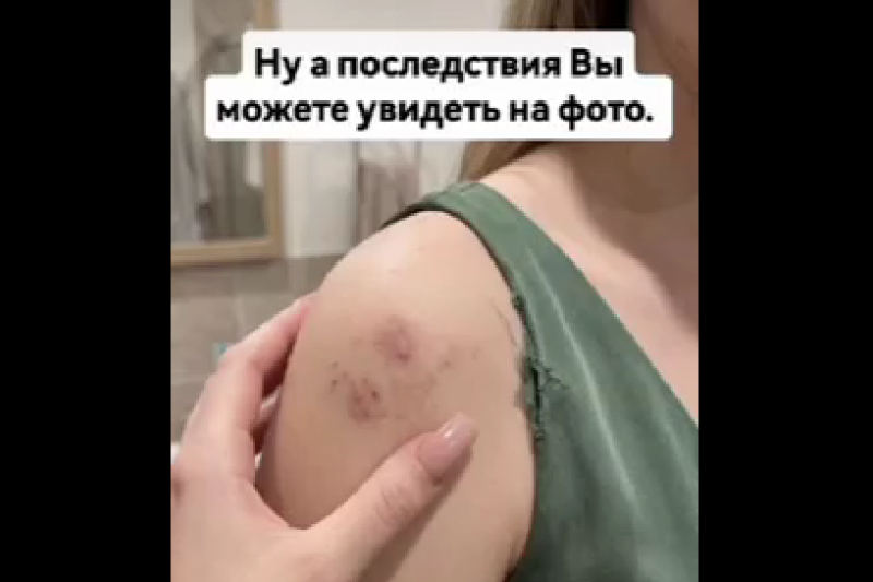 Во Львове официант ресторана избил гражданок Молдовы за русский язык
